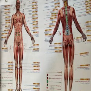 خرائط الحجامة  متر/متر و نصف